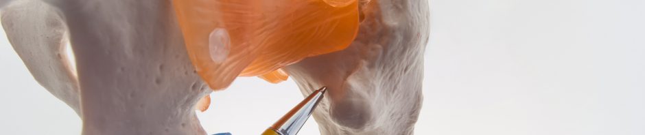 Indianapolis Hip Injury Lawyers
