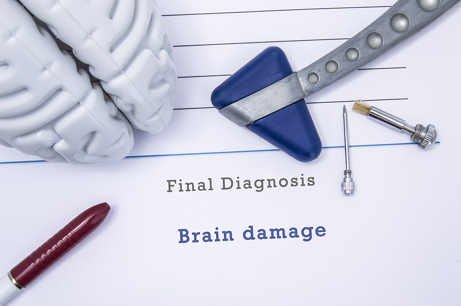 Call 317-881-2700 to Speak With a Trusted Brain Damage Lawyer in Indianapolis Indiana