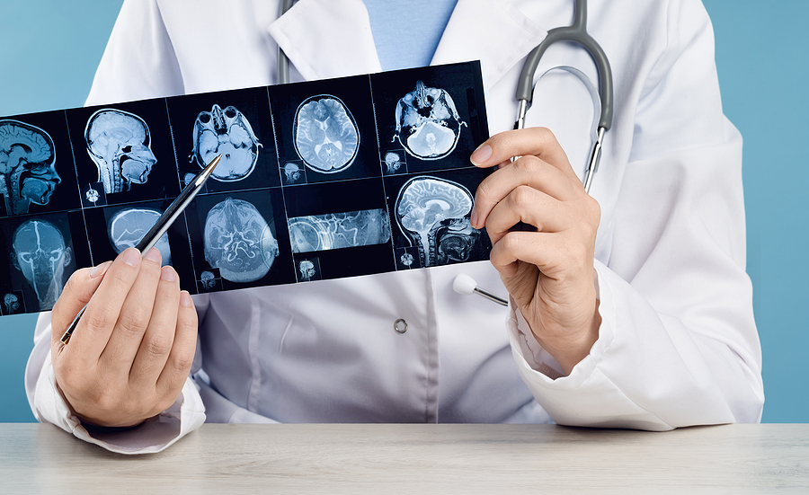 Call 317-881-2700 to Speak With Our Indiana Head Injury Lawyers