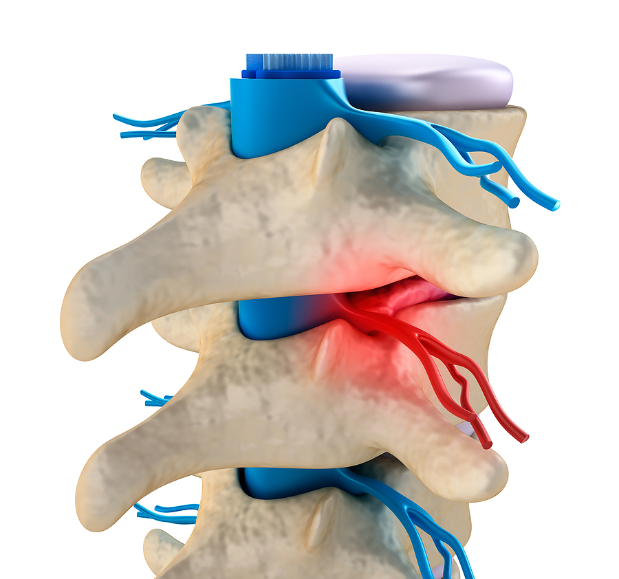 Call 317-881-2700 to Get in Touch With an Experienced Personal Injury Lawyer in Indiana